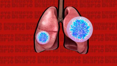 Photo of Atención tardía de cáncer de pulmón eleva muertes y costos en Latinoamérica